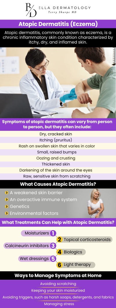 Eczema can be a frustrating condition, with constant trial and error to find the right treatment. It causes inflamed, dry patches on the skin that lead to discomfort and irritation. While a perfect solution may not exist, with patience and the right approach, many people can manage their symptoms effectively. Visit Dr. Terry L. Sharpe, MD, for personalized treatment options to manage your eczema symptoms effectively. For more information, contact us or request an appointment online. We are conveniently located at 1365 Rock Quarry Rd, Suite 300 Stockbridge, GA 30281. Eczema can be a frustrating condition, with constant trial and error to find the right treatment. It causes inflamed, dry patches on the skin that lead to discomfort and irritation. While a perfect solution may not exist, with patience and the right approach, many people can manage their symptoms effectively. Visit Dr. Terry L. Sharpe, MD, for personalized treatment options to manage your eczema symptoms effectively. For more information, contact us or request an appointment online. We are conveniently located at 1365 Rock Quarry Rd, Suite 300 Stockbridge, GA 30281.